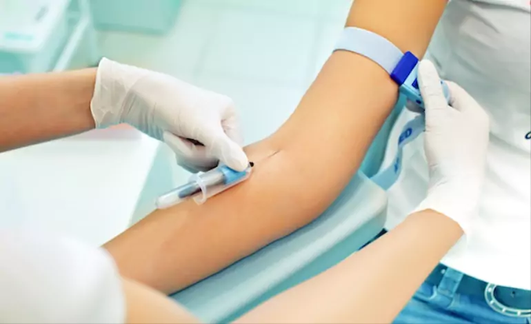 Mastering Blood Test Preparation: Your Comprehensive Guide